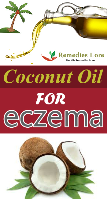 coconut-oil-for-eczema