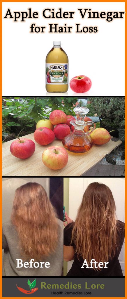 apple cider for hair loss