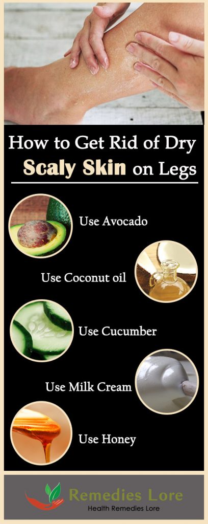 how to get rid of scalpy skin on legs