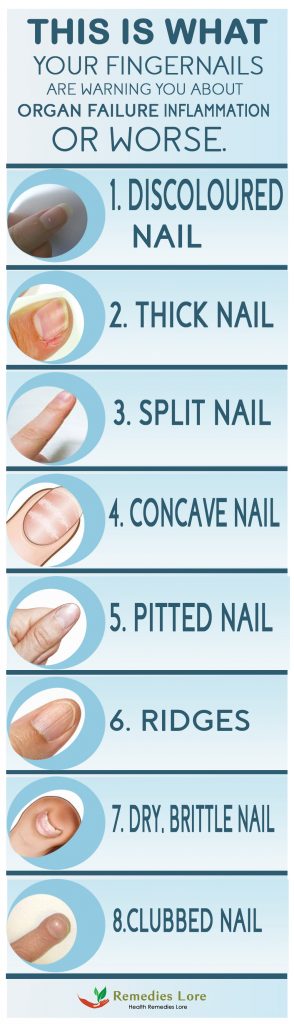 This is what Your Fingernails Are Warning you