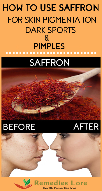 How to use saffron for skin pigmentation,