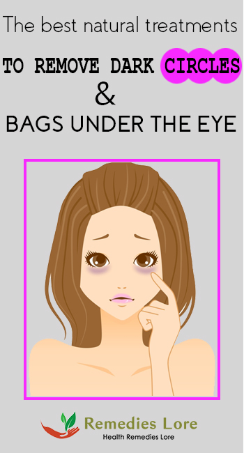 The Best Natural Treatments To Remove Dark Circles and Bags Under The Eyes_1