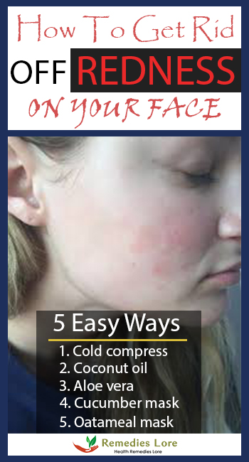 How to Get Rid off Redness on Your Face – 5 easy ways