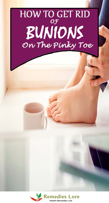 How to Get Rid of Bunions on the Pinky Toe