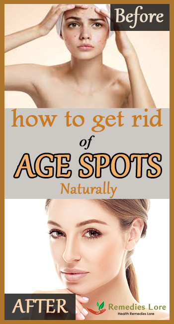 How to get rid age spots naturally