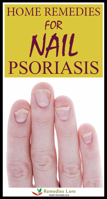 home-remedies-nail-psoriasis