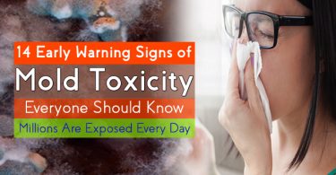 mold toxicity signs early warning everyone know should applying polish nail body after millions exposed every happens hours