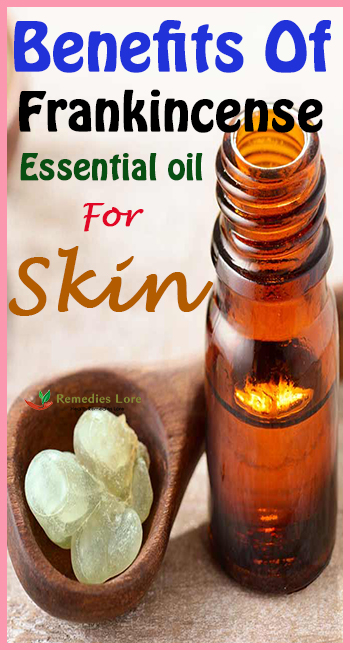 benefits of frankincense essential oil for skin