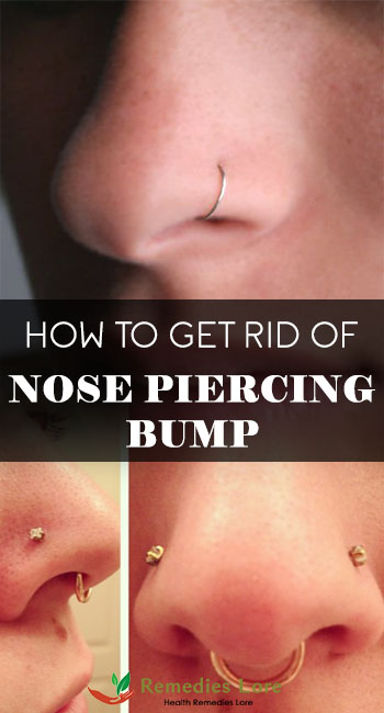 How to Get Rid of Nose Piercing Bump