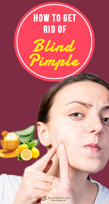 How to Get Rid of Blind Pimple