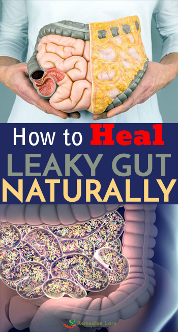 How to Heal Leaky Gut Naturally