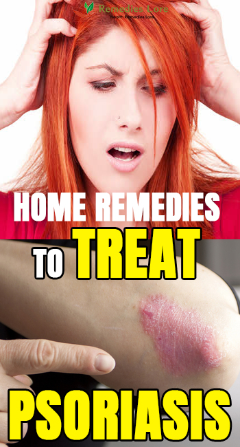 Home Remedies To Treat Psoriasis