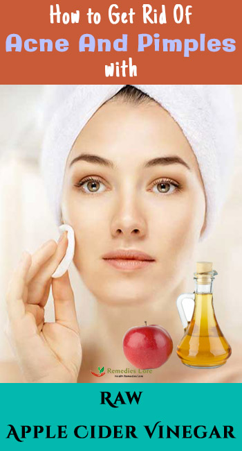 How to Get Rid Of Acne And Pimples With Raw Apple Cider Vinegar