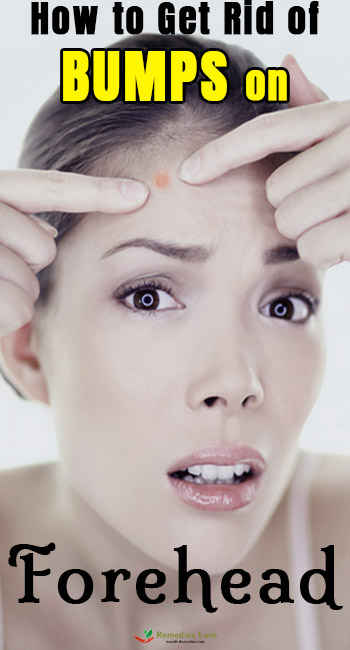 How to Get Rid of Bumps on Forehead