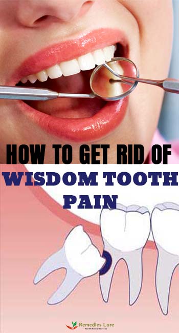 How to Get Rid of Wisdom Tooth Pain