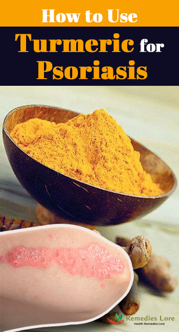How to Use Turmeric for Psoriasis