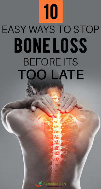 10 Easy Ways To Stop Bone Loss Before Its Too Late