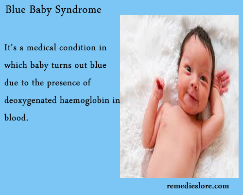 Blue Baby Syndrome - Symptoms and Diagnosis - Remedies Lore