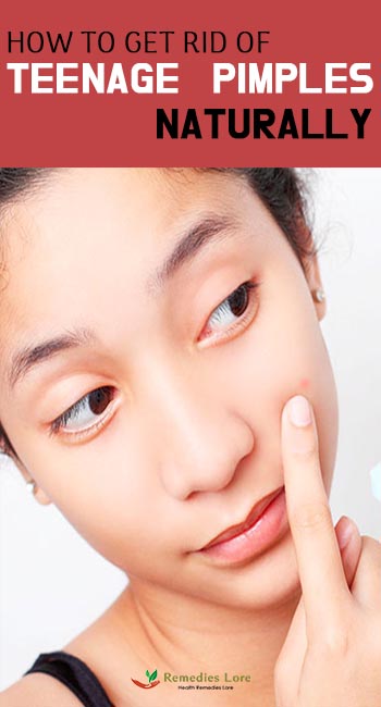 How To Get Rid Of Teenage Pimples Naturally - Remedies Lore
