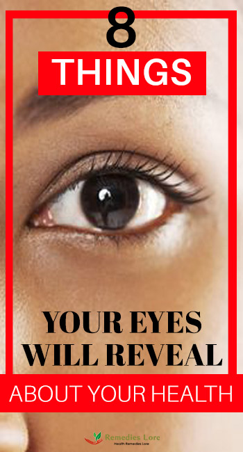8 Things Your Eyes Will Reveal About Your Health