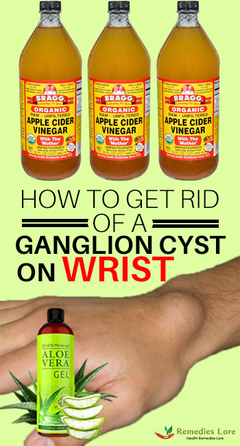 How to Get Rid of a Ganglion Cyst on Wrist