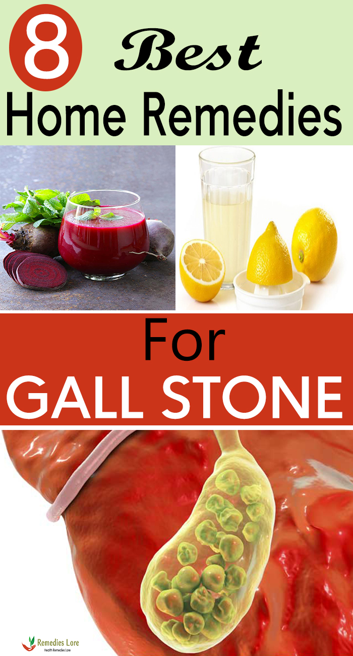 8 Best Home Remedies For Gall Stone