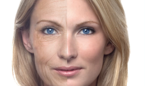 reasons-for-skin-aging