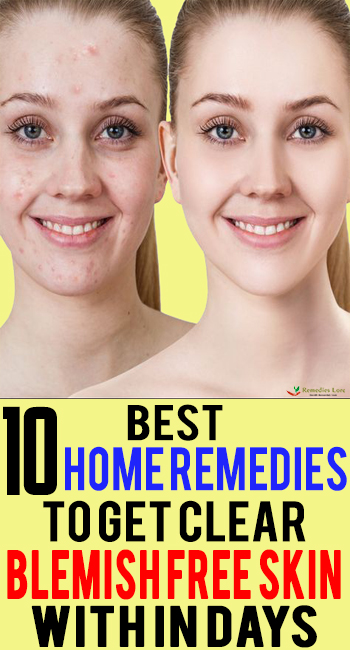 10 Best Home Remedies To Get Clear Blemish Free Skin with in Days