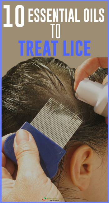 10 essential oils to treat lice