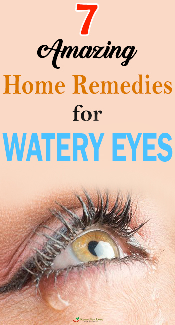 7 Amazing Home Remedies For Watery Eyes