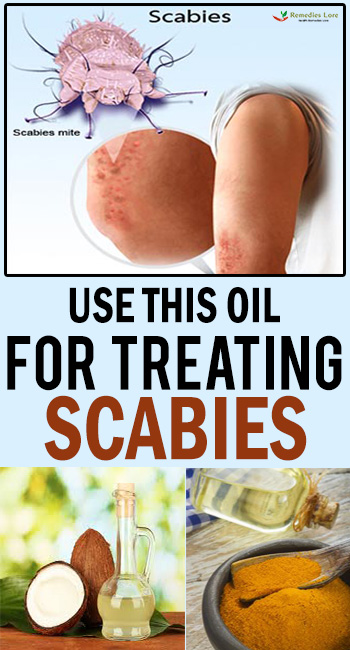 Use This Oil For Treating Scabies
