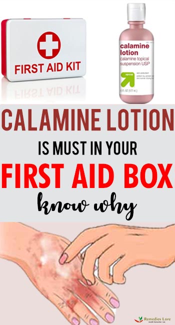 calamine lotion is must in your first aid box ......
