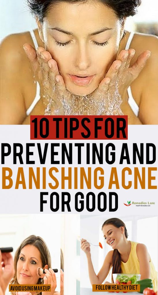 10 Tips For Preventing And Banishing Acne For Good