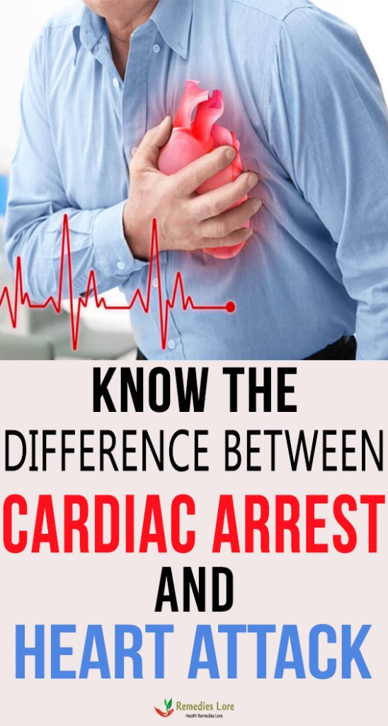 Know The Difference Between Cardiac Arrest And Heart Attack