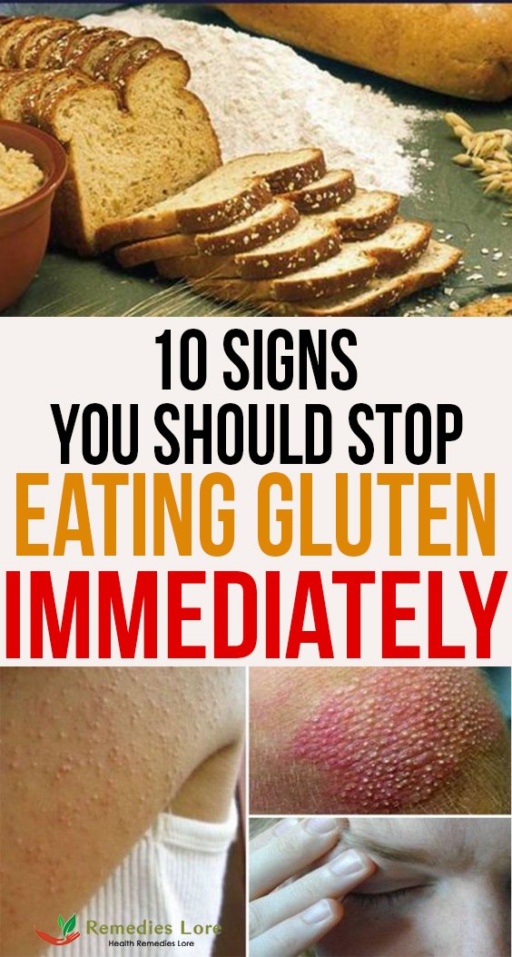 10 Signs You Should Stop Eating Gluten Immediately