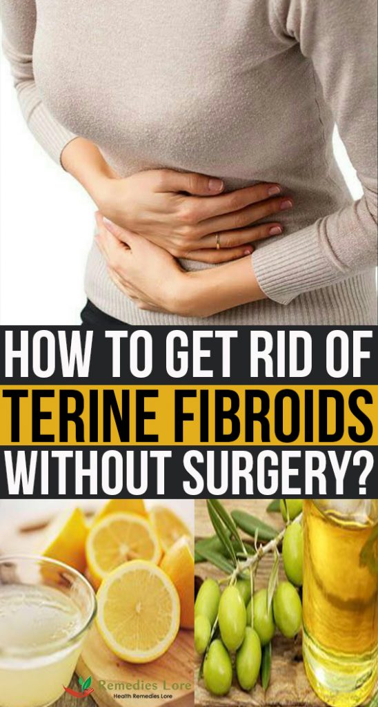 How to Get Rid of Uterine Fibroids without Surgery