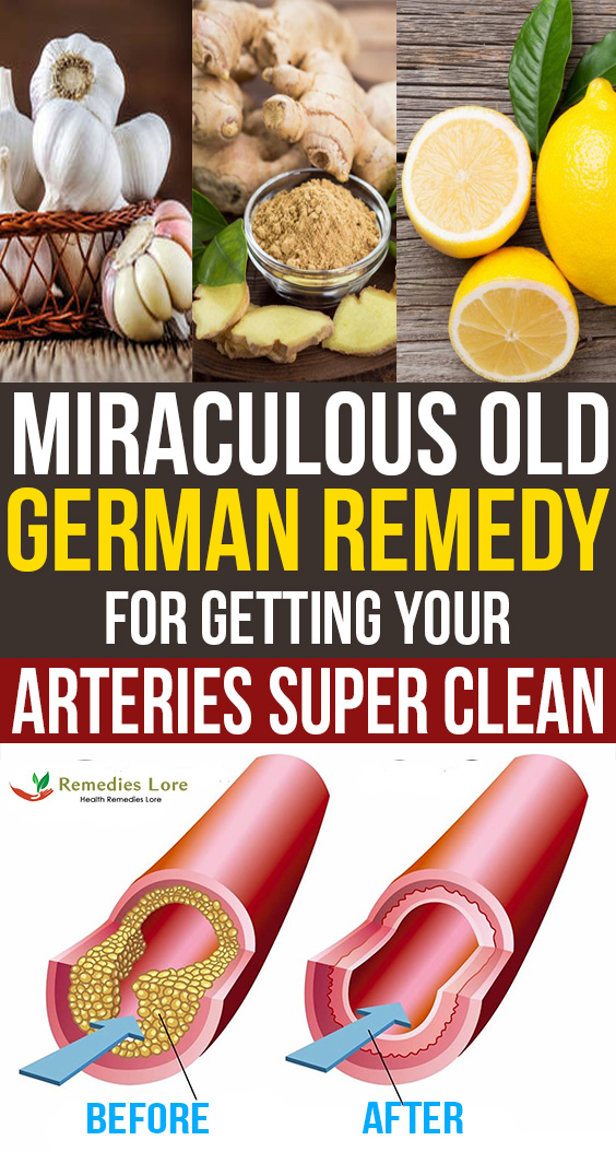 Miraculous Old German Remedy for Getting Your Arteries Super Clean