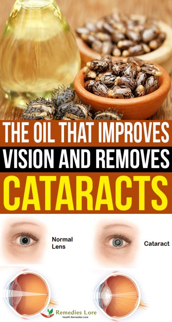 The oil that improves vision and cataract- How to use castor oil to improve vision and remove cataracts--Recovered