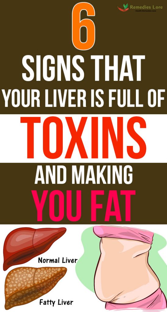 6 signs that your liver is full of toxins and making you fat