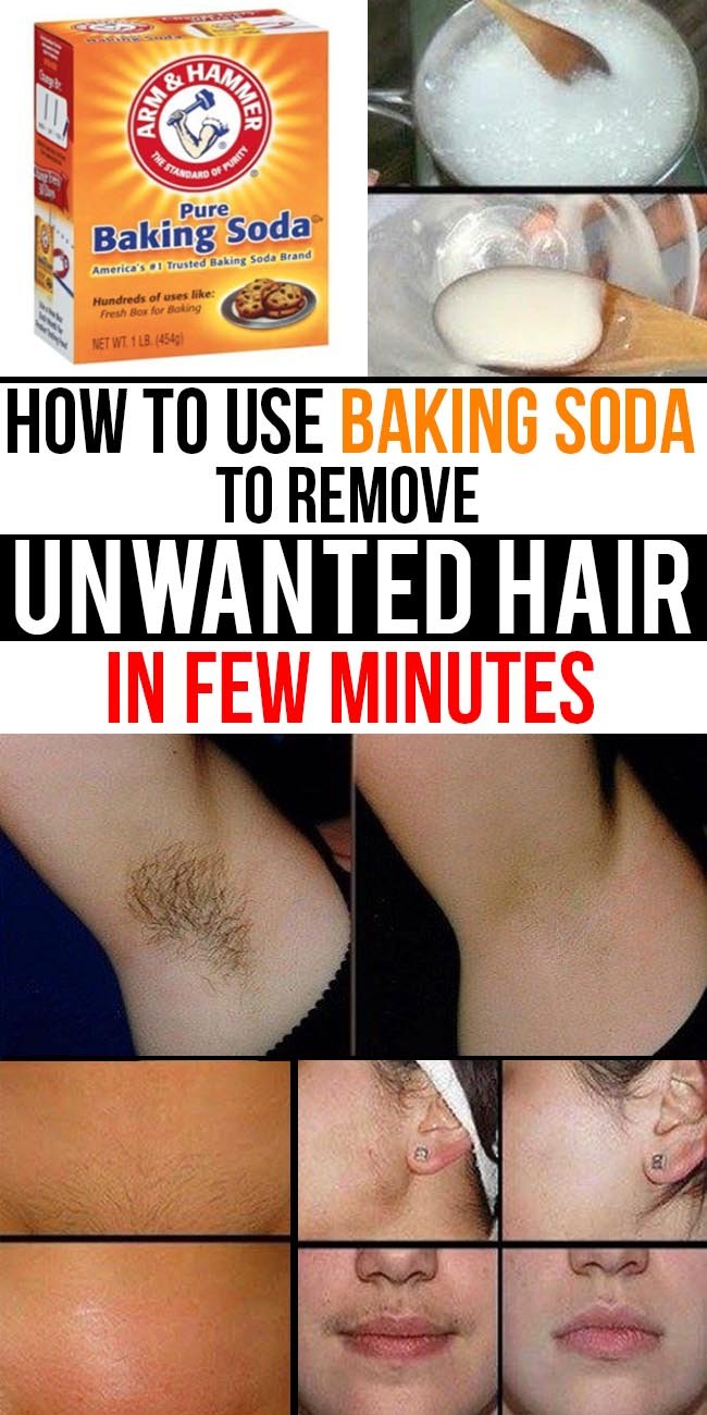 How To Use Baking Soda To Remove Unwanted Hair In Few Minutes