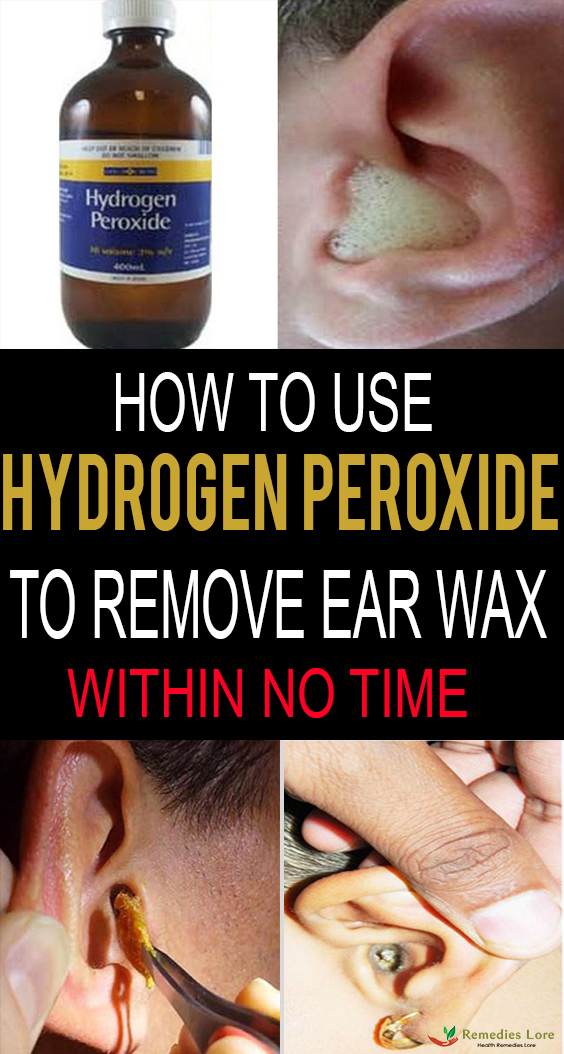 How to use Hydrogen Peroxide to remove Ear Wax-
