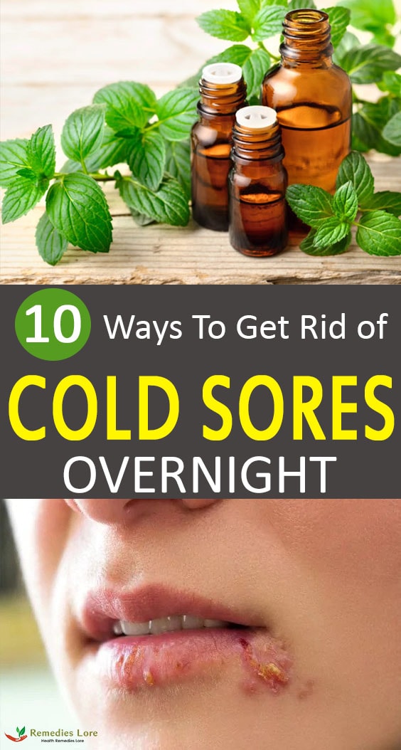 How To Get Rid Of Cold Sores – 10 Effective Ways To Try