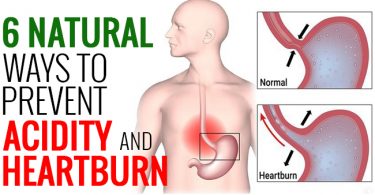 Natural Ways to Prevent Acidity And Heartburn