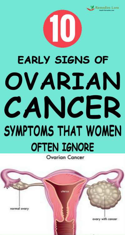 Early signs of ovarian cancer 