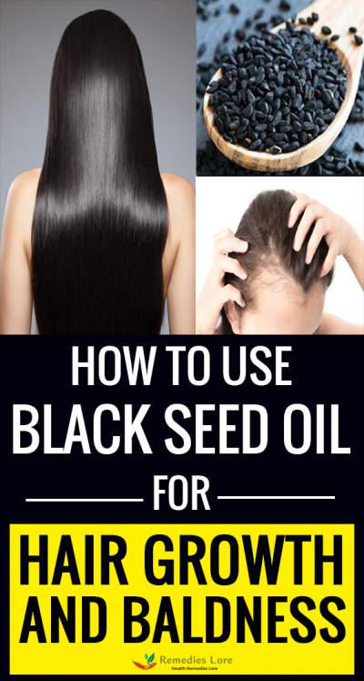 How to Use Black Seed Oil (Kalonji) For Hair Growth and Baldness ...