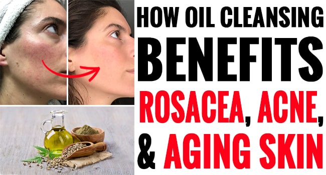 How Oil Cleansing Benefits Rosacea, Acne, And Aging Skin